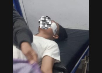 Jalan Poros Pangkajene-Rappang Jadi “Lubang Maut”, Empat Pengendara Jadi Korban dalam Dua Malam